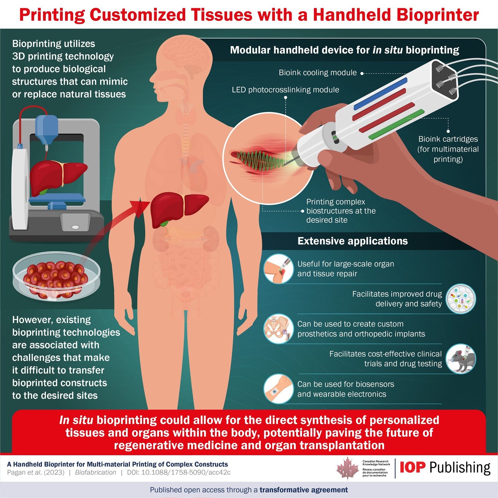 How do organ care technology and 3D bioprinting benefit transplant medicine?
